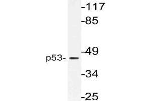Western blot (WB) analysis of p53 antibody in extracts from 293 cells. (p53 anticorps)