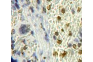 Used in DAB staining on fromalin fixed paraffin-embedded Spleen tissue (Inhibitory Subunit of NF-KappaB zeta (AA 414-654) anticorps)