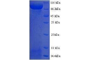 SDS-PAGE (SDS) image for Lysyl Oxidase-Like 2 (LOXL2) (AA 26-776) protein (His tag) (ABIN5713616)