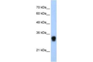 Western Blotting (WB) image for anti-Ribosomal Protein L8 (RPL8) antibody (ABIN2462054) (RPL8 anticorps)