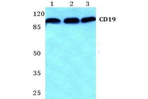 Western Blot analysis of CD19 antibody at 1/500 dilution: Lane 1: MCF-7 cell lysate. (CD19 anticorps)