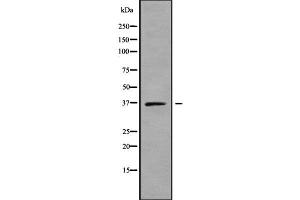 Western blot analysis SLC25A14 using K562 whole cell lysates (SLC25A14 anticorps  (Internal Region))