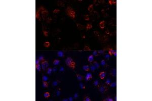 Immunofluorescence analysis of  cells using  antibody (ABIN7265429) at dilution of 1:100.