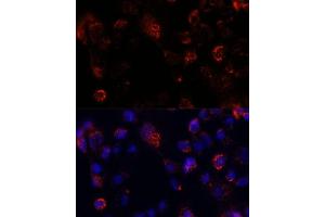Immunofluorescence analysis of  cells using  antibody (ABIN7265429) at dilution of 1:100. (ACOT9 anticorps  (AA 22-250))