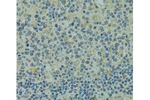 Immunohistochemistry of paraffin-embedded Human tonsil using IVNS1ABP Polyclonal Antibody at dilution of 1:100 (40x lens). (IVNS1ABP anticorps)
