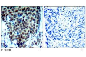 Image no. 2 for anti-Mitogen-Activated Protein Kinase 14 (MAPK14) (pThr180) antibody (ABIN197010) (MAPK14 anticorps  (pThr180))
