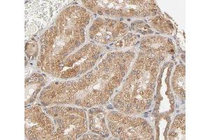 ABIN6267622 at 1/200 staining human kidney tissue sections by IHC-P. (PTPN11 anticorps  (pTyr580))