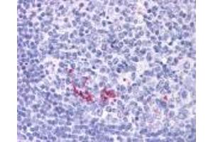 RANKL/TRANCE/CD254 Immunohistochemistry.