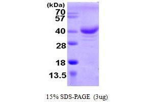 SDS-PAGE (SDS) image for Zinc Finger, CCHC Domain Containing 17 (ZCCHC17) (AA 1-241) protein (His tag) (ABIN667891)