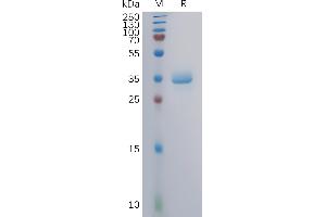 Human GA Protein, mFc Tag on SDS-PAGE under reducing condition.