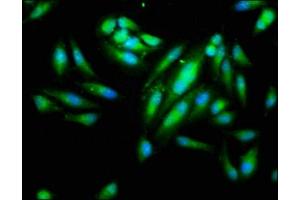 Immunofluorescence staining of Hela cells with ABIN7156207 at 1:266, counter-stained with DAPI. (IDO1 anticorps  (AA 1-403))