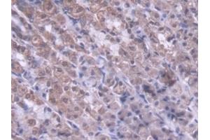 Detection of MTX1 in Rat Stomach Tissue using Polyclonal Antibody to Metaxin 1 (MTX1) (Metaxin 1 anticorps  (AA 163-324))