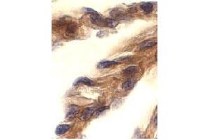 Immunohistochemistry of TICAM1 in human lung tissue with TICAM1 polyclonal antibody  at 10 ug/mL .
