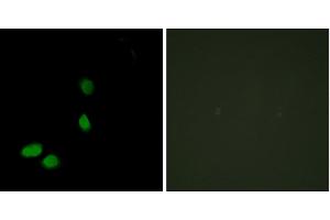 Immunofluorescence analysis of HeLa cells, using HMG17 antibody.