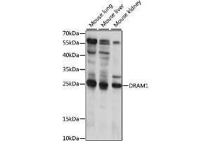 Western blot analysis of extracts of various cell lines, using DR antibody (ABIN7266817) at 1:1000 dilution. (DRAM anticorps  (AA 100-200))