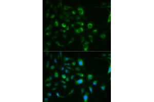 Immunofluorescence analysis of MCF-7 cells using TLR8 antibody. (TLR8 anticorps)