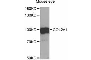 Western blot analysis of extracts of mouse eye, using COL2A1 antibody (ABIN1871948) at 1:1000 dilution. (COL2A1 anticorps)
