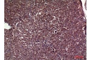 Immunohistochemistry (IHC) analysis of paraffin-embedded Human Pancreas, antibody was diluted at 1:100.