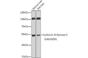 Western blot analysis of extracts of various cell lines, using Carbonic Anhydrase 9 (C/G250) antibody (ABIN6131267, ABIN6137799, ABIN6137801 and ABIN6218748) at 1:100 dilution. (CA9 anticorps  (AA 52-151))