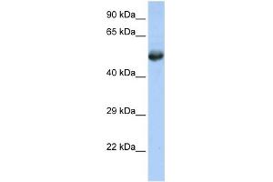WB Suggested Anti-FLI1 Antibody Titration:  0. (FLI1 anticorps  (Middle Region))