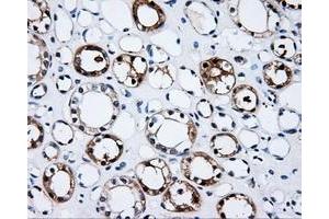 Immunohistochemical staining of paraffin-embedded Kidney tissue using anti-PSMC3 mouse monoclonal antibody. (PSMC3 anticorps)