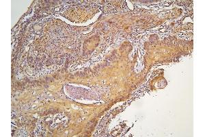 IHC analysis of HOOK3 using anti-HOOK3 antibody (ABIN6719547). (HOOK3 anticorps  (AA 14-198))