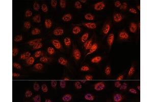 Immunofluorescence analysis of U-2 OS cells using RBM25 Polyclonal Antibody at dilution of 1:100. (RBM25 anticorps)
