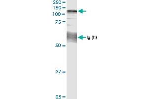 Immunoprecipitation of CC2D1A transfected lysate using anti-CC2D1A MaxPab rabbit polyclonal antibody and Protein A Magnetic Bead , and immunoblotted with CC2D1A MaxPab rabbit polyclonal antibody (D01) .