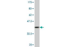 Western Blot detection against Immunogen (37. (ZNF180 anticorps  (AA 176-285))