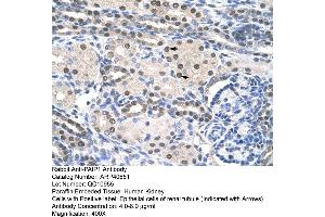Rabbit Anti-PAIP1 Antibody  Paraffin Embedded Tissue: Human Kidney Cellular Data: Epithelial cells of renal tubule Antibody Concentration: 4. (PAIP1 anticorps  (C-Term))