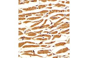 (ABIN6242565 and ABIN6578213) staining PGM1 in human heart tissue sections by Immunohistochemistry (IHC-P - paraformaldehyde-fixed, paraffin-embedded sections).
