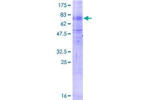 Image no. 1 for Major Facilitator Superfamily Domain Containing 2A (MFSD2A) (AA 1-530) protein (GST tag) (ABIN1310813)