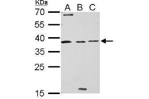 WB Image Livin antibody detects BIRC7 protein by Western blot analysis. (BIRC7 anticorps)
