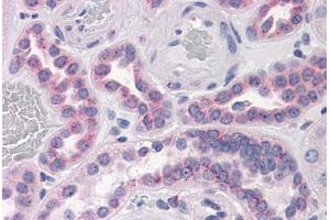 Human Kidney: Formalin-Fixed, Paraffin-Embedded (FFPE) (GPR3 anticorps  (AA 1-331))