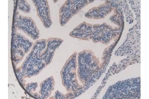 Detection of GSTM1 in Mouse Ovary Tissue using Polyclonal Antibody to Glutathione S Transferase Mu 1 (GSTM1)