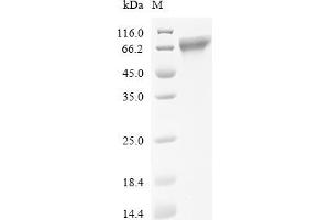 Coagulation Factor IX (F9) (AA 29-461), (full length) protein (His tag)