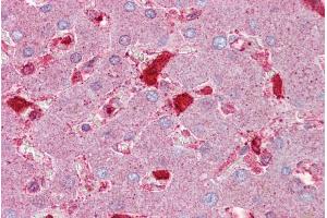 Immunohistochemistry with Liver tissue at an antibody concentration of 5µg/ml using anti-SERPINC1 antibody (ARP41402_P050)
