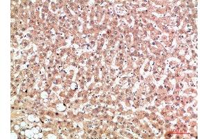 Immunohistochemical analysis of paraffin-embedded human-liver, antibody was diluted at 1:200