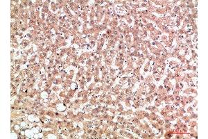 Immunohistochemical analysis of paraffin-embedded human-liver, antibody was diluted at 1:200 (EPG5 anticorps  (AA 141-190))