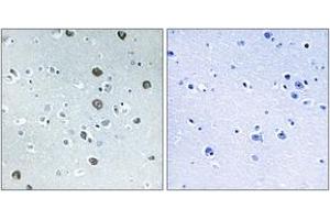 Immunohistochemistry (IHC) image for anti-Membrane-Associated Ring Finger (C3HC4) 2, E3 Ubiquitin Protein Ligase (MARCH2) (AA 191-240) antibody (ABIN2890284) (MARCH2 anticorps  (AA 191-240))
