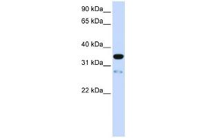 TMEM38A antibody used at 1 ug/ml to detect target protein. (TMEM38A anticorps  (N-Term))