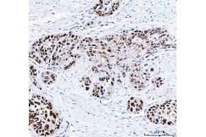 IHC analysis of FEN1 using anti-FEN1 antibody (ABIN7601617). (FEN1 anticorps  (AA 4-300))