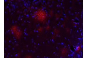 Indirect immunostaining of a PFA fixed formic acid treated brain section from a triple transgenic Alzheimer´s disease mouse (dilution 1 : 500; red). (Abeta 1-42 anticorps)