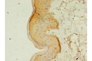 Immunohistochemistry of paraffin-embedded human skin tissue using ABIN7167192 at dilution of 1:100 (RERG anticorps  (AA 1-199))