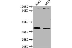 Western Blot Positive WB detected in: K562 whole cell lysate, A549 whole cell lysate All lanes: TMOD1 antibody at 1:1000 Secondary Goat polyclonal to rabbit IgG at 1/50000 dilution Predicted band size: 41, 27 kDa Observed band size: 41 kDa (Tropomodulin 1 anticorps  (AA 105-359))