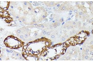 Immunohistochemistry of paraffin-embedded Rat kidney using LTF Polyclonal Antibody at dilution of 1:100 (40x lens). (Lactoferrin anticorps)