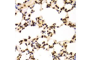 Immunohistochemistry of paraffin-embedded Mouse lung using DiMethyl-Histone H3-K4 antibody (ABIN1872995) at dilution of 1:100 (40x lens). (Histone 3 anticorps  (H3K4me2))