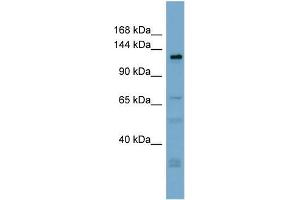 Human ACHN; WB Suggested Anti-TMEM16C Antibody Titration: 0. (ANO3 anticorps  (Middle Region))