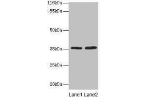 Western blot All lanes: ACKR1 antibody at 2 μg/mL Lane 1: Mouse kidney tissue Lane 2: Mouse spleen tissue Secondary Goat polyclonal to rabbit IgG at 1/10000 dilution Predicted band size: 36 kDa Observed band size: 36 kDa (DARC anticorps  (AA 1-63))