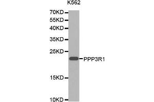 Western blot analysis of extracts of K-562 cells lines, using PPP3R1 antibody. (PPP3R1 anticorps  (AA 11-170))
